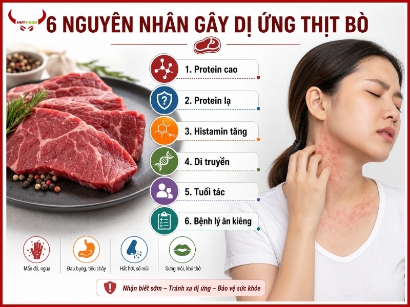 6 nguyên nhân gây dị ứng thịt bò