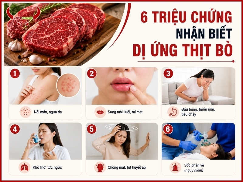 6 triệu chứng nhận biết dị ứng thịt bò